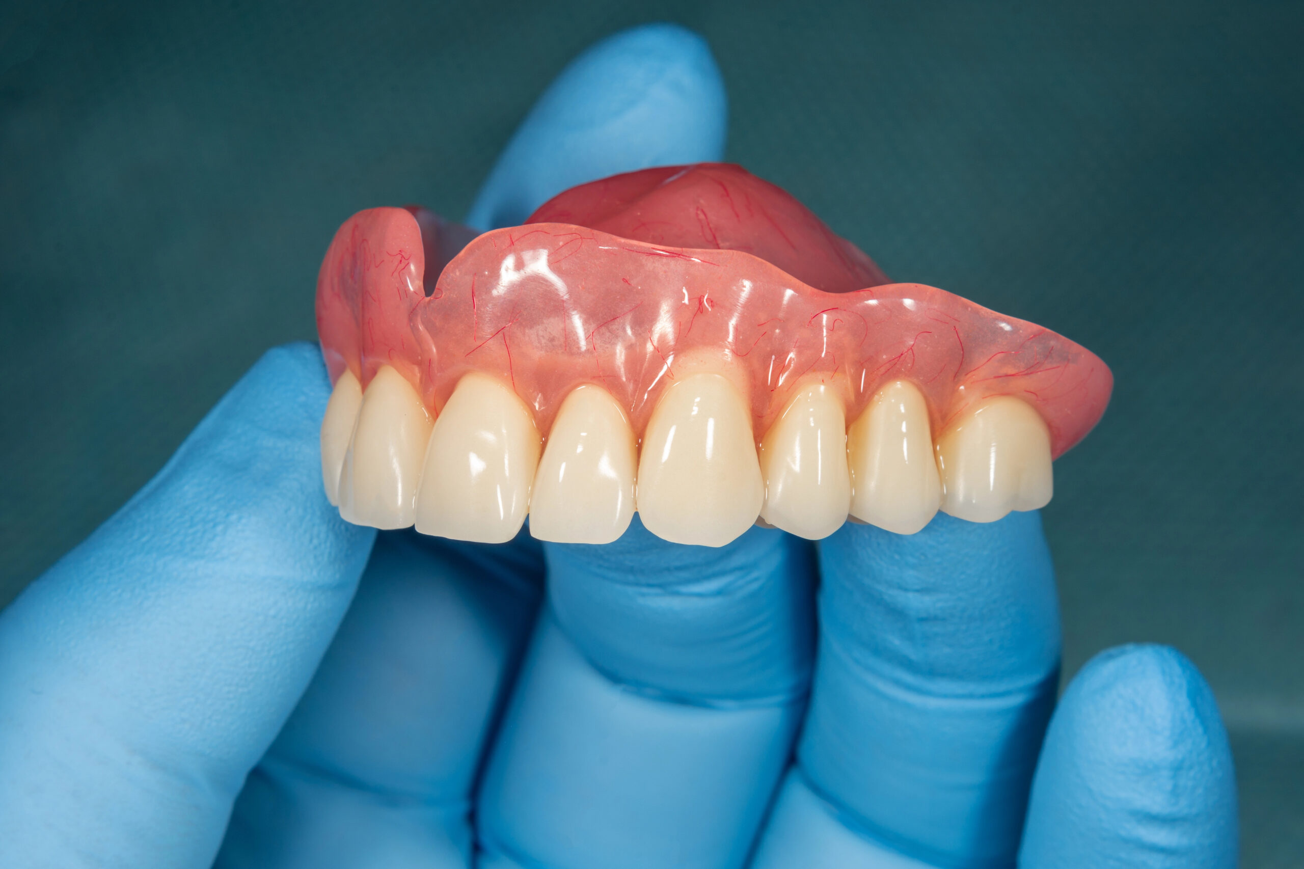 Immediate vs. Complete Dentures in Stoneham