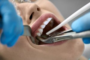 Blog | Lund Dental Associates Blog